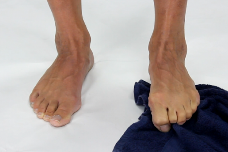 3 Best AtHome Exercises For Hammer Toes Kim Holistic Foot & Ankle Center