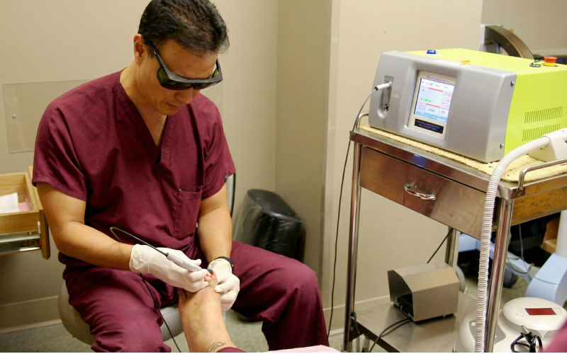 Laser Treatment For Toenail Fungus