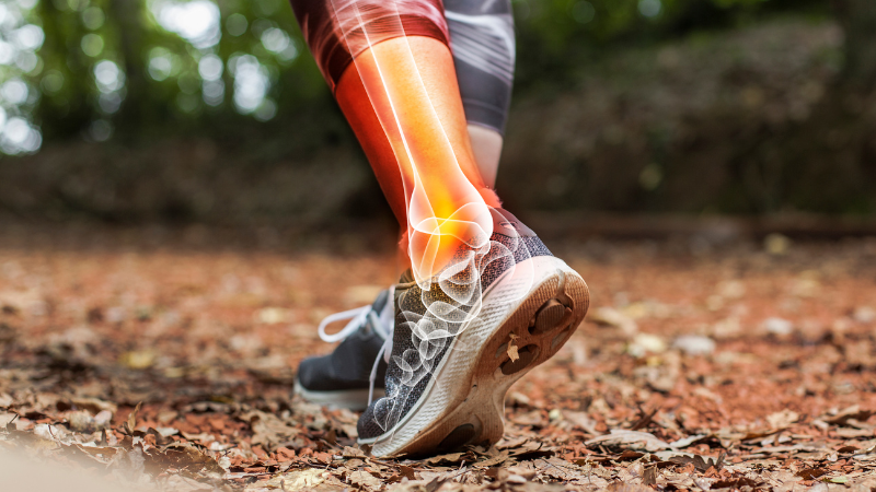 Chronic Ankle Instability