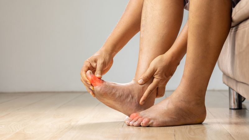 Gout Treatment