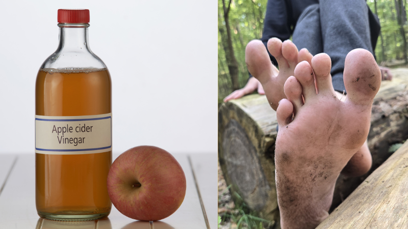 Apple Cider Vinegar for Smelly Feet